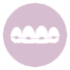 ortodonzia-mobile-fissa-apparecchio-denti-n